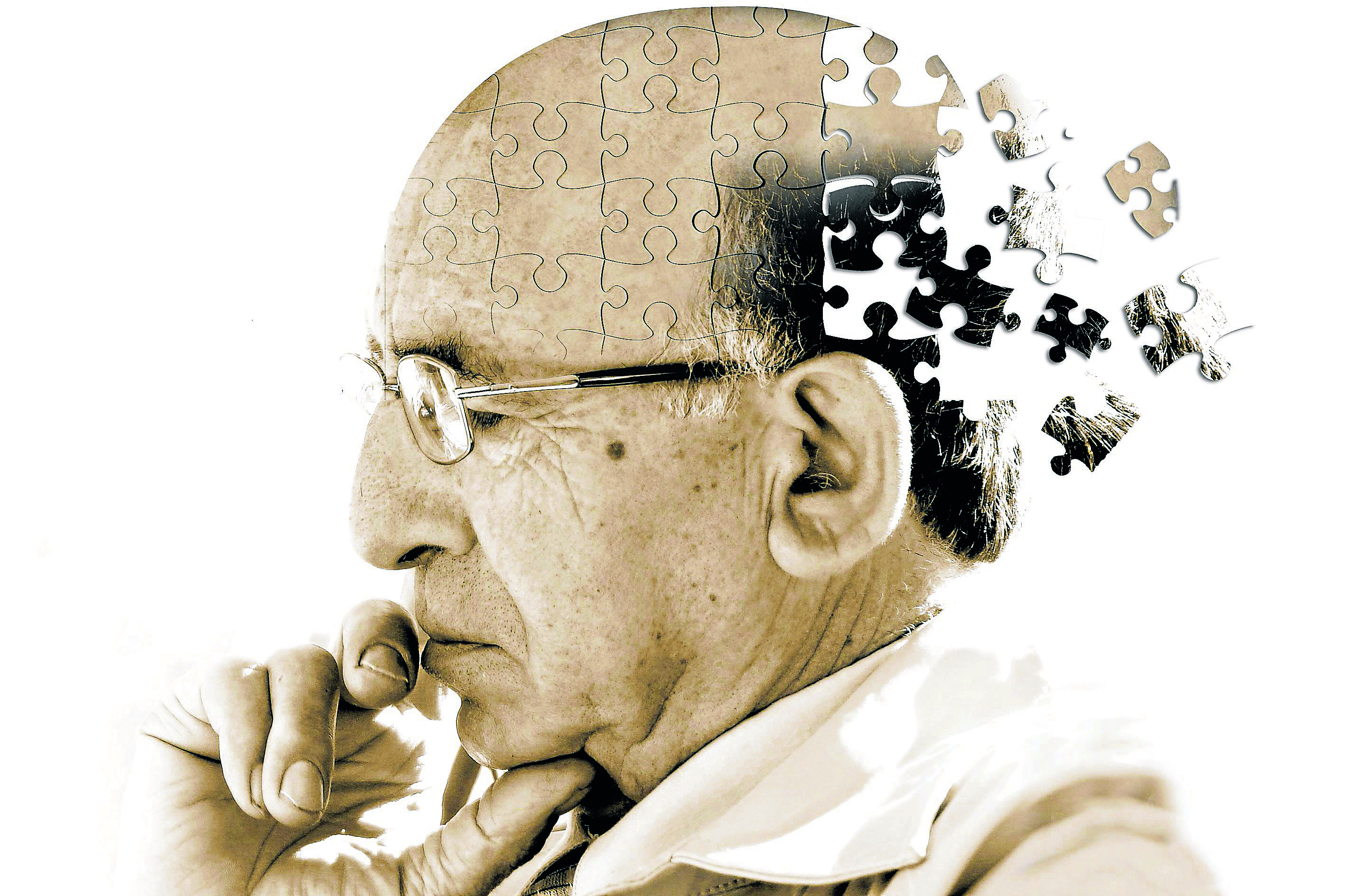 Dolgok, melyek Alzheimer-kórhoz vezetnek